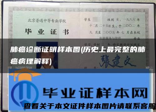 肺癌诊断证明样本图(历史上最完整的肺癌病理解释)