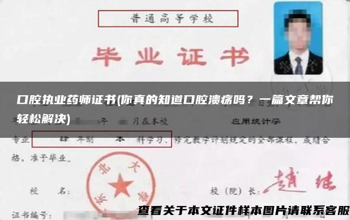 口腔执业药师证书(你真的知道口腔溃疡吗？一篇文章帮你轻松解决)