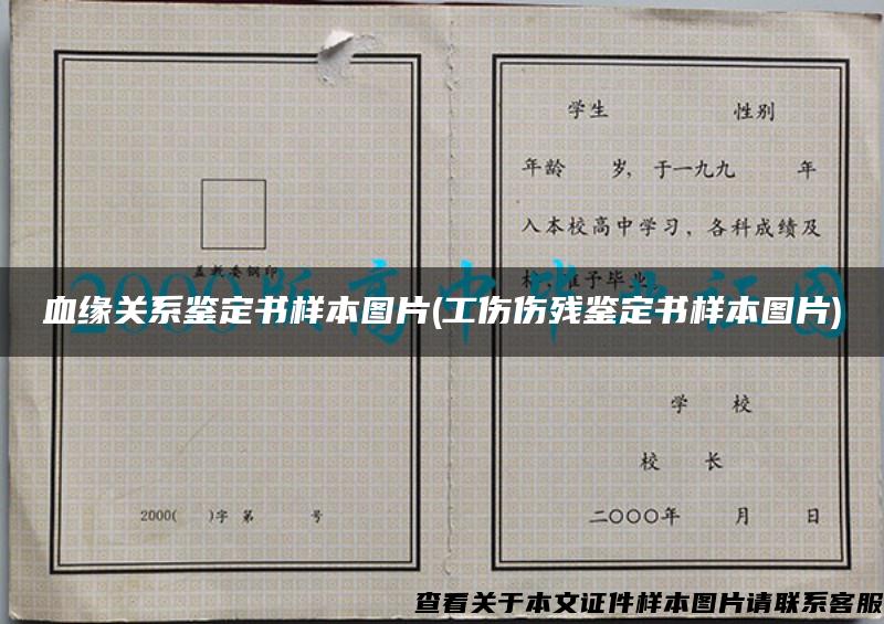 血缘关系鉴定书样本图片(工伤伤残鉴定书样本图片)