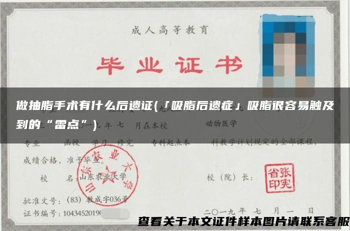 做抽脂手术有什么后遗证(「吸脂后遗症」吸脂很容易触及到的“雷点”)