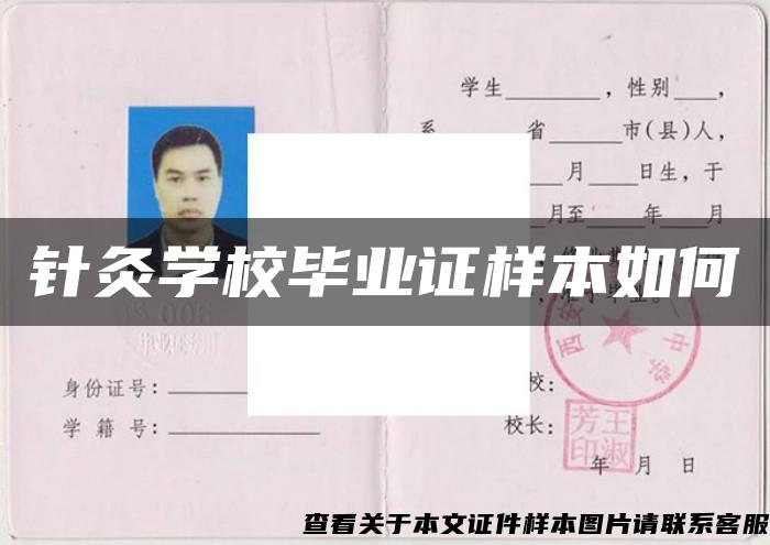 针灸学校毕业证样本如何