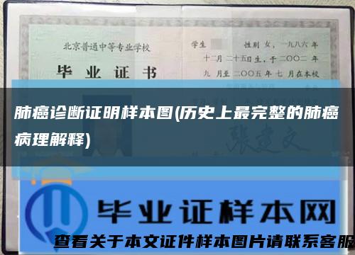 肺癌诊断证明样本图(历史上最完整的肺癌病理解释)缩略图