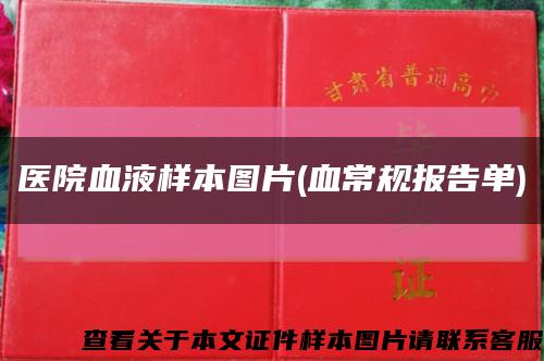 医院血液样本图片(血常规报告单)缩略图