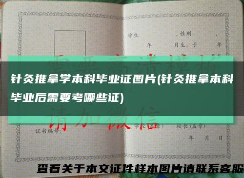 针灸推拿学本科毕业证图片(针灸推拿本科毕业后需要考哪些证)缩略图