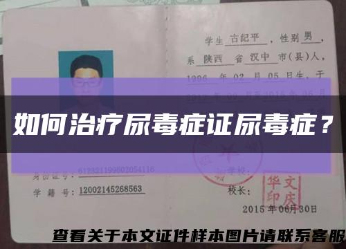 如何治疗尿毒症证尿毒症？缩略图