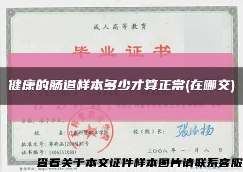 健康的肠道样本多少才算正常(在哪交)缩略图