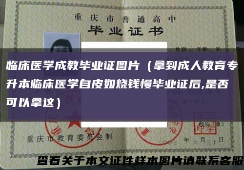 临床医学成教毕业证图片（拿到成人教育专升本临床医学自皮如烧钱慢毕业证后,是否可以拿这）缩略图